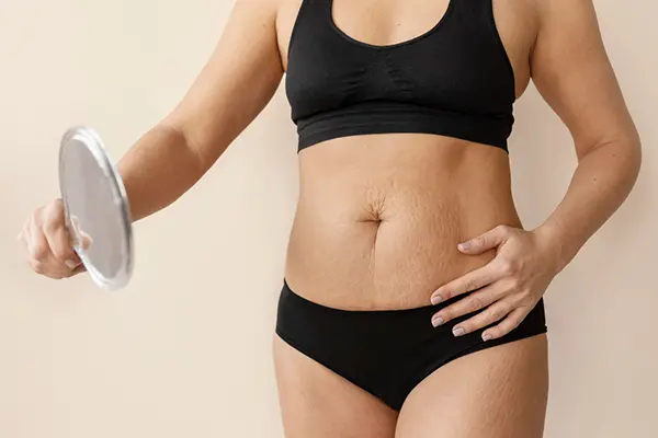 Después de someterse a una cesárea, es natural que se pregunte cómo bajar la barriga después del embarazo con cirugía. En esta guía, desde el consultorio del Dr. Jair Brown...
